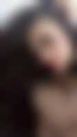 صورة العضو